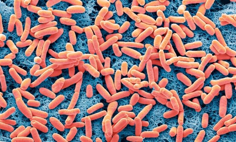 سحب جديد لبراعم الفجل في الولايات المتحدة بسبب E. coli والسالمونيلا.. FDA توسع تحذيراً غذائياً