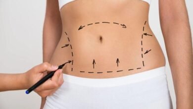 دكتور التجميل علي عبد علي يتحدث عن عملية شفط الدهون